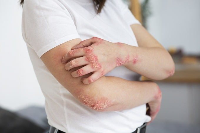 कवक से होने वाले रोग  - Human Fungal Diseases List In Hindi