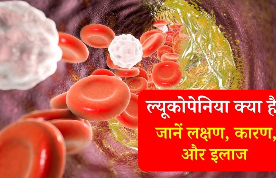 ल्यूकोपेनिया (WBC की कमी) के प्रकार, कारण, लक्षण, इलाज - What Is Leukopenia (Low White Blood Cell Count) In Hindi