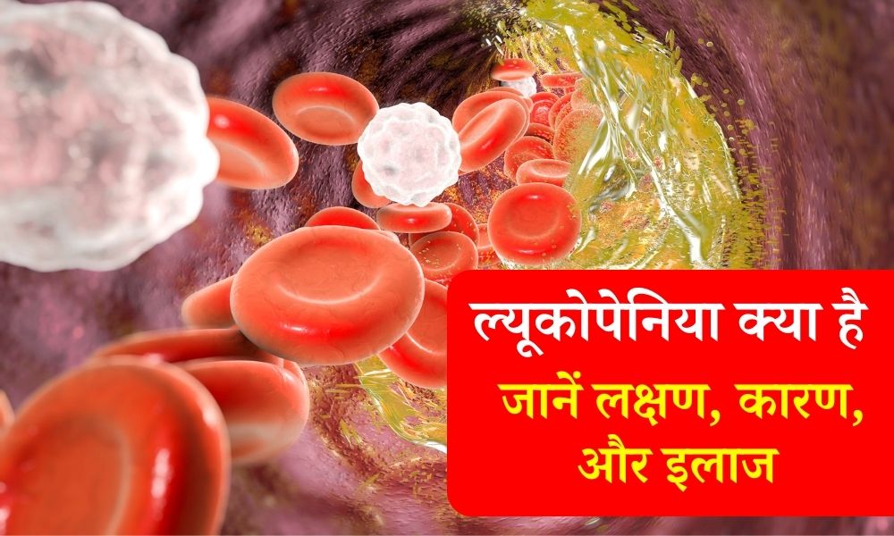 ल्यूकोपेनिया (WBC की कमी) के प्रकार, कारण, लक्षण, इलाज - What Is Leukopenia (Low White Blood Cell Count) In Hindi