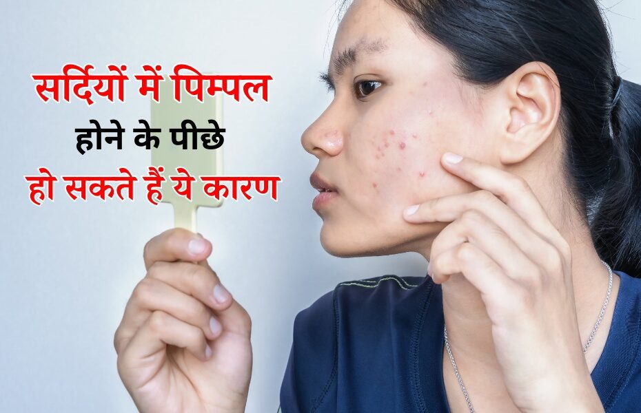 सर्दियों में होते हैं आपके फेस पर भी पिम्पल तो जानिए इसके पीछे की वजह - 6 Causes Of Acne On Face In Winter In Hindi 