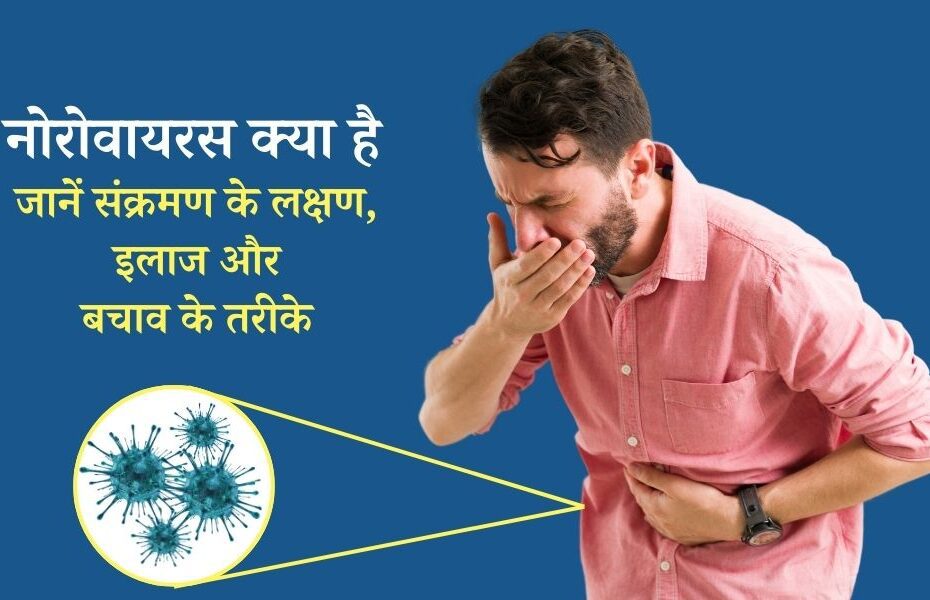 नोरोवायरस क्या है, इसके कारण, लक्षण, इलाज और बचाव - Norovirus Causes, Symptoms, Treatment And Prevention In Hindi